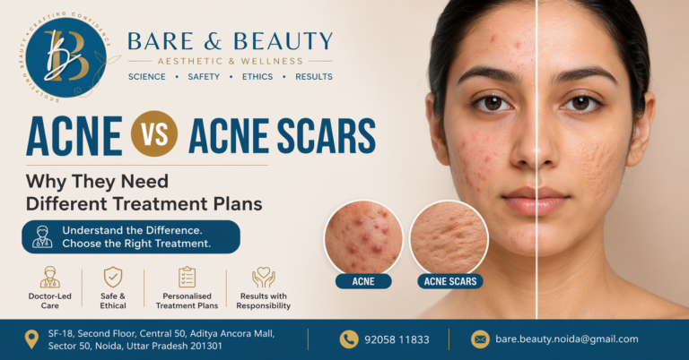 Acne vs Acne Scar Treatments