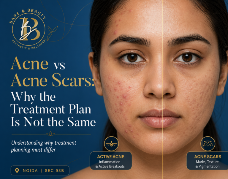 Acne vs Acne Scars